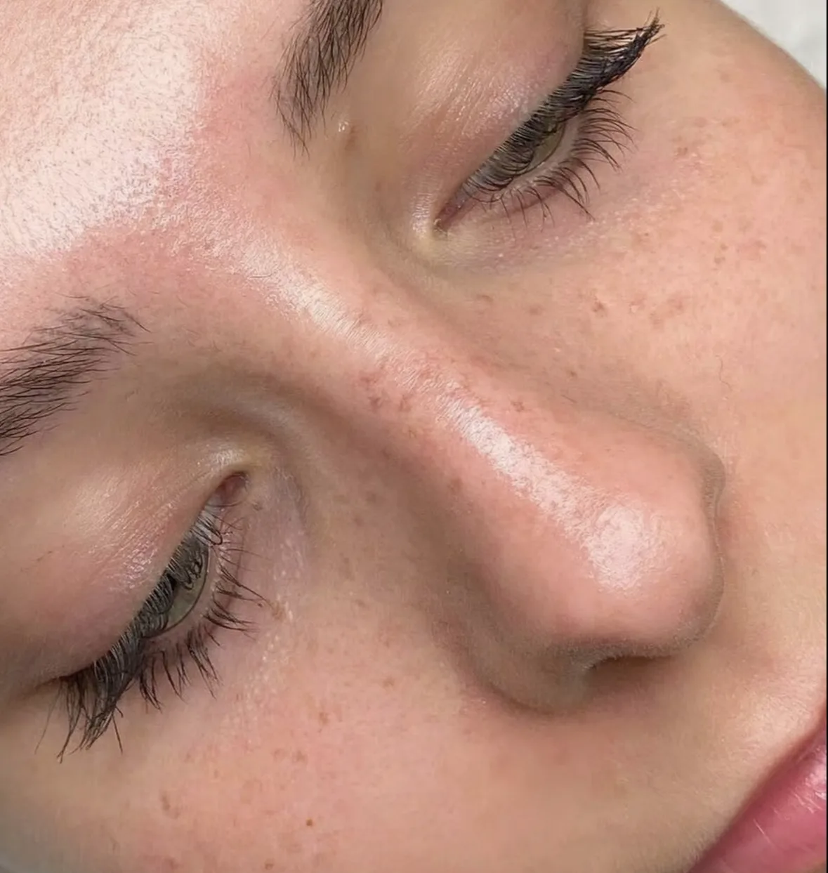 Tatouage taches de rousseur freckles Vendée